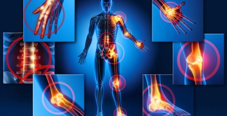 Pontos de Drores na Fibromialgia para ser tratado com laser