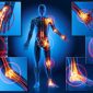 Pontos de Drores na Fibromialgia para ser tratado com laser